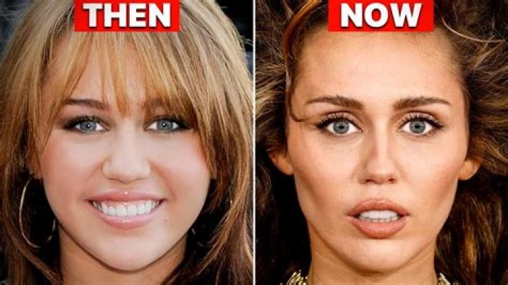 Did Laura Kightlinger Undergo Plastic Surgery, Why Does Her Face Look So Different?