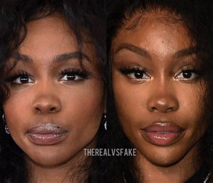 Onyii Alex Before and After Surgery Photos On Instagram: Everything About The Nigerian Actress